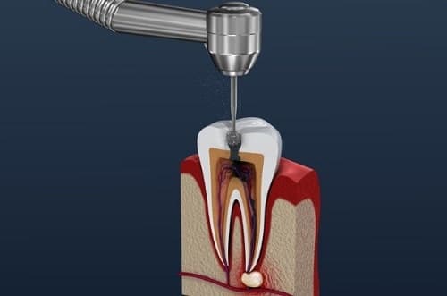 prueba de la mordida en dentista