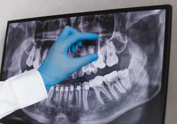 identificación de las piezas dentales